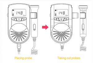 Fetal Doppler - Baby Heart Monitor